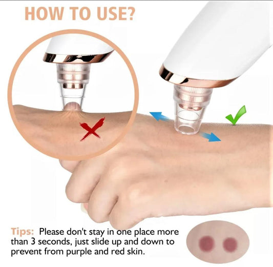 Rechargeable Blackhead Removal Machine Derma Suction