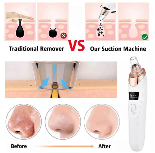 Rechargeable Blackhead Removal Machine Derma Suction